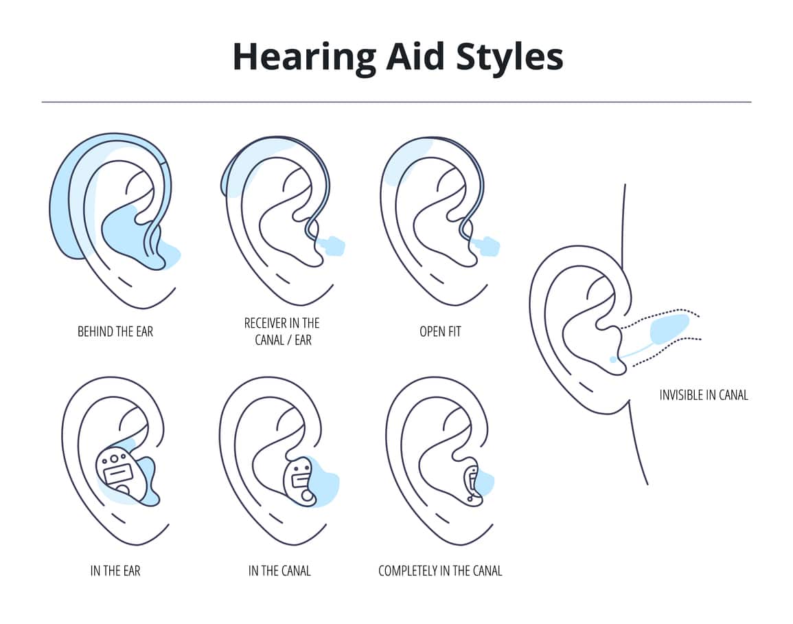 Types of hearing aid illustration.